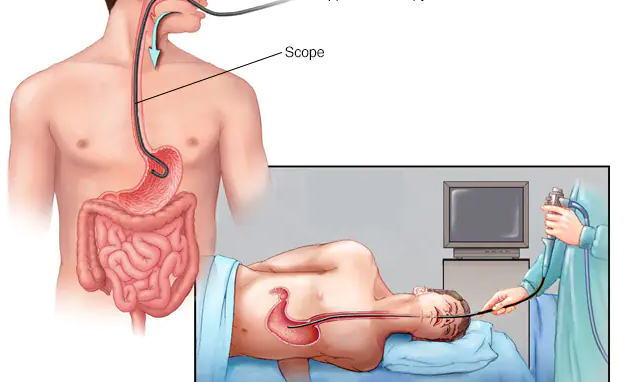 Best endoscopy Rewa