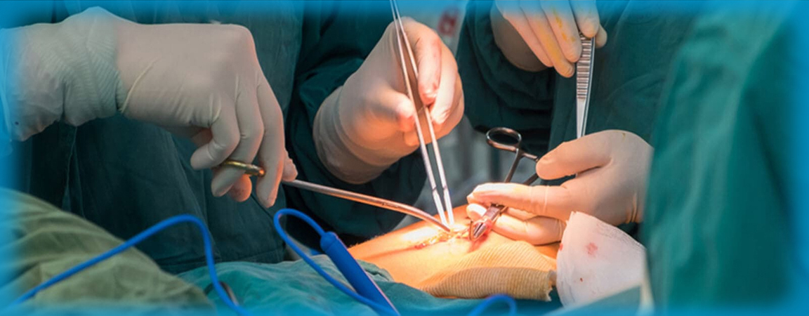 Best Surgery national hospital rewa